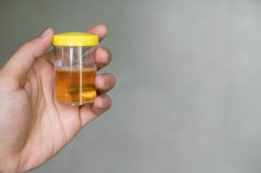 mao masculina segura recipiente com xixi em fundo cinza indicando exame toxicologico