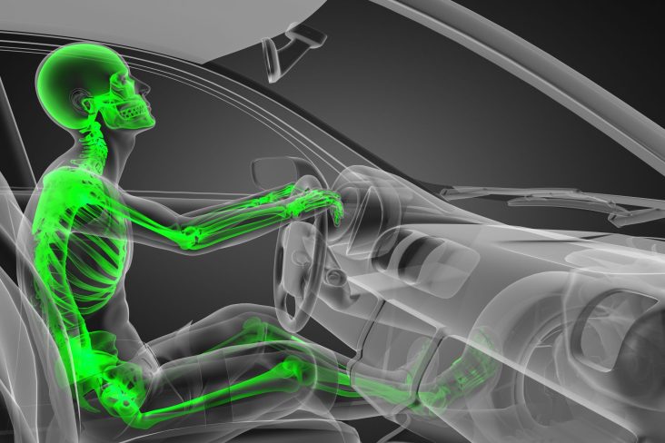 COLUNA VERTEBRAL POSIÇÃO NO CARRO RAIO X SHUTTERSTOCK