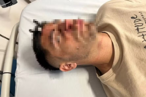 Chave De Carro É Cravada Na Testa De Jogador Após Briga