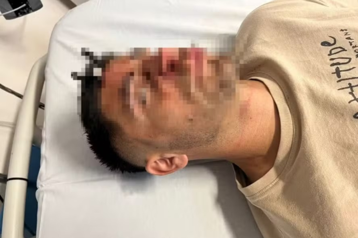 Chave De Carro É Cravada Na Testa De Jogador Após Briga