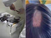 Exame toxicológico para CNH amostra de cabelo