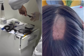 Exame toxicológico para CNH amostra de cabelo